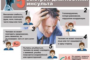 5 симптомов инсульта