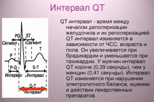 Интервал электрической активности сердца (QT)